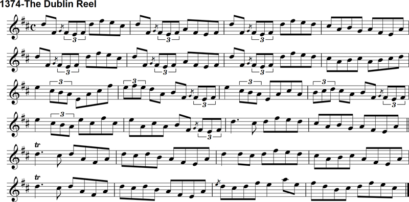 Reel: The Dublin Reel